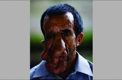 އެލެފަންޓް މޭން: މަދު ނަމަވެސް ބިރުވެރި ބައްޔެއް