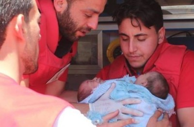 ސީރިއާގައި އެއް ހަށިގަނޑުން ގުޅިފައިވާ ދެ ކުދިންނަށް ފަރުވާ ބޭނުންވެފައި