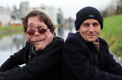 މި އެއްމާބަނޑު ދެބެއިން އުފަންވި އިރު ސިފަ އެއްގޮތް