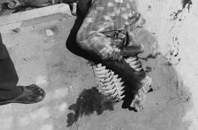 ސައިކަލުން ޖެހުނު މީހާގެ ހާލު ސީރިއަސް: ކުޅުދުއްފުށީ ހޮސްޕިޓަލް
