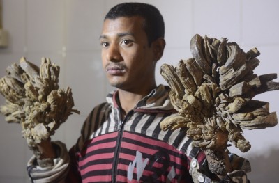 ބަންގްލަދޭޝްގެ "ގަސް މީހާ" އަށް މިހާރު ދަރިފުޅު އުރާލެވޭ