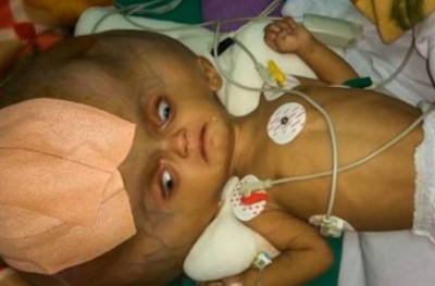 އާދަޔާޚިލާފަށް ބޯ ބޮޑު ކުއްޖާ އޮޕަރޭޝަން ކޮށްފި