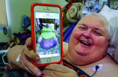 ޑޮކްޓަރުން ބުނީ ސަރުބީއޭ، އޮތީ 59 ކިލޯގެ ޓިއުމަރެއް