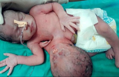 ކުއްޖެއްގެ ބަނޑުން ނުކުމެފައި އިން ބޮލެއް ވަކިކޮށްފި