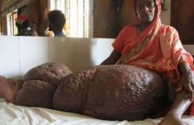 ބަންގްލަދޭޝް މީހެއްގެ ފައިގައި 60 ކިލޯ