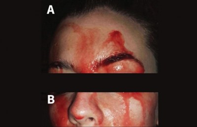 ދާހިތްލާ ގޮތަށް ލޭ އަންނަ މީހެއް، ޑޮކްޓަރުން އަޖައިބުވެފައި