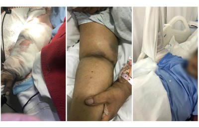 އޭޑީކޭގެ ޑޮކްޓަރެއްގެ އިހުމާލުން މީހަކު މަރުވި ކަމަށް ބުނާ މައްސަލައެއް ބަލަނީ