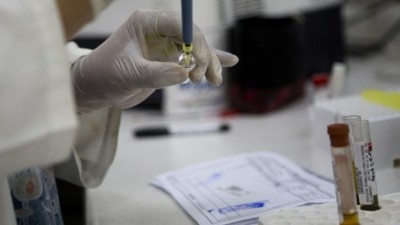 ޖިންސީ ގުޅުމުން ޒިކާ ވައިރަސް ފެތުރޭކަން ކަށަވަރުވެއްޖެ