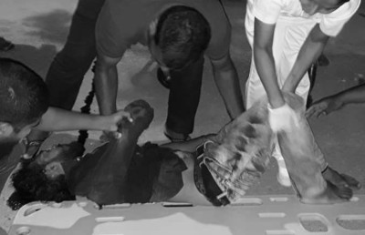 އައްޑޫގައި އެކްސިޑެންޓު ވި ދެ މީހުން ސީރިއަސް، ފަރުވާ އަށް މާލެ ފޮނުވާލަނީ