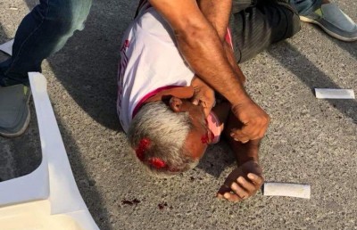 ޕީޕީއެމްގެ ވެހިކަލް ބުރެއްގައި ޕިކަޕަކުން ވެއްޓި މީހަކަށް އަނިޔާވެއްޖެ