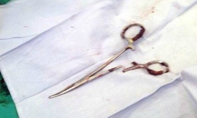 ވިއެޓްނާމް މީހެއްގެ ބަނޑުގައި 18 އަހަރު ވަންދެން އޮތް ކަތުރެއް ނަގައިފި