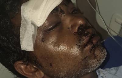 ކޮޗިންގައި ހިނގި އެކްސިޑެންޓެއްގައި ދިވެއްސަކަށް އަނިޔާވެއްޖެ
