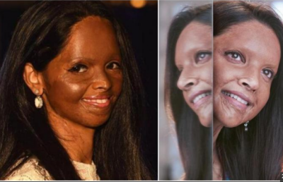"ޗަޕާކް"ގައި ދީޕިކާ ފެންނަނީ އެސިޑުގެ ހަމަލާއެއްގެ ޝިކާރައަކަށްވެފައިވާ މީހެއްގެ ގޮތުގައި