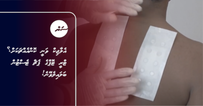 އެލާޖިކް ވަނީ ކޮންއެއްޗަކަށް؟ ޓްރީ ޓޮޕްގެ ޕެޗް ޓެސްޓުން ބަލައިލެވޭނެ!