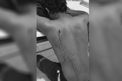 މާމެންދޫ މާރާމާރީގައި ޒަހަމްވި ޒުވާނާގެ ހާލު ރަނގަޅު