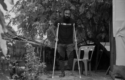 ގެއްލުނީ އެއް ފައި، ހާލުގައިޖެއްސި ބަޔަކު ވެސް ނޭނގެ