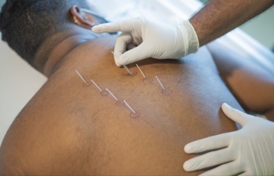 ޑްރައި ކަޕިން އާއި ނީޑްލިންގެ ހިދުމަތް ޓްރީޓޮޕުން ތައާރަފުކޮށްފި