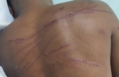 ސިފައިންގެ މީހާ އަށް ހުރީ ވަރަށް ބޮޑަށް އަނިޔާކޮށްފައި