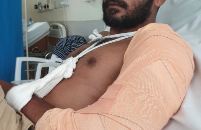 ލަވަކިޔުންތެރިޔާ ފަތޯގެ އަތް ބިންދާލުމުން އޮޕަރޭޝަން ނުކުރެވި ހޮސްޕިޓަލުގައި