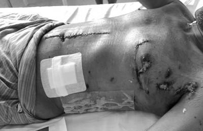 ފަރުވާދެނިކޮށް ނަޝީދުގެ ވިންދު ހުއްޓުނު: ޑރ.ނިޔާފް