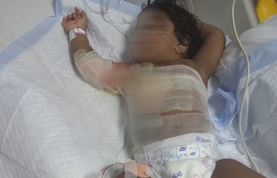 ހޫނު ފެންތައްޓެއް ބަންޑުންވެ ކުޑަ ކުއްޖަކު ވަރަށް ބޮޑަށް ފިހިފައި