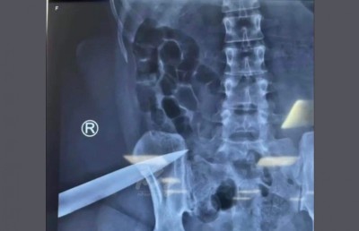 ވަޅިހެރީ ކާކު؟، ދެ މީހުންގެ ގަޔަށް ވެސް ވަޅި ހެރި!