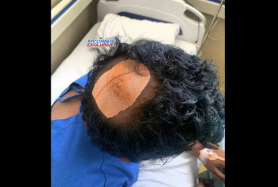 މެންބަރު ޒަރީރަށް ހަމަލާ ދިނީ ފަސް މީހުންގެ ގްރޫޕަކުން