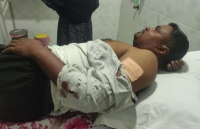 މިލަންދޫ ކައުންސިލަރަކަށް ހަމަލާދީ ޒަހަމްކޮށްލައިފި، ތުހުމަތުކުރަނީ މެންބަރު ރިޒާއަށް