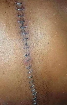 ޑޮކްޓަރު ބުނީ އޮންނަންޖެހޭނީ އެނދުގައޭ، އެކަމަކު އަފްރާހް ތެދުވެއްޖެ