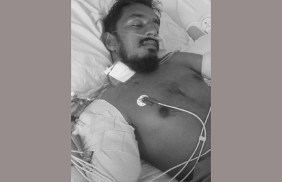 އަތްބުރިވި މީހާއަށް ޕްރޮސްތެސިސްޓް ޝަފީއު މަސްނޫއީ އަތެއް ހަދައިދޭން ހުށަހަޅައިފި