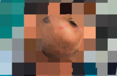 ދަރިވަރަކަށް ބުލީކޮށް އަނިޔާކުރި މައްސަލައެއް މިނިސްޓްރީން ބަލަނީ