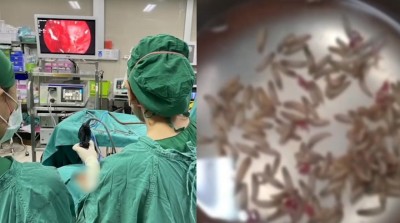 ނޭފަތް ބެދިގެން ބެލިއިރު ނޭފަތް ތެރޭގައި ފުޅަ