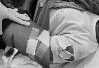 ކުޑަދޮރެއް ވެއްޓުން: ދަރިފުޅުގެ ފަރުވާގެ ބޭނުމެއްގައި ދަނިކޮށް، ބައްޕައަށް ބޮޑެތި އަނިޔާތަކެއް