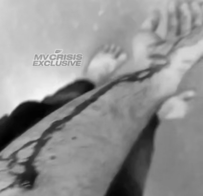 މަރުތޭލަކުން ހަމަލާދިނުން: ހާދިސާގައި ހަރަކާތްތެރިވި ފުލުހަކަށް ވަނީ އަނިޔާ ލިބިފައި