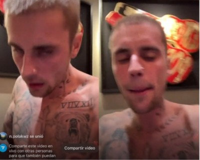 ކަންބޮޑުވާ ލައިވްސްޓްރީމަކަށްފަހު ޖަސްޓިން އެކައުންޓް ޑިލީޓް