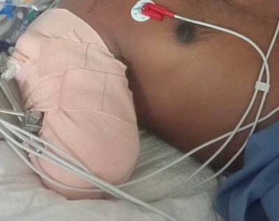 ފީނަން އުޅެނިކޮށް ލޯންޗެއްގައި ޖެހި ބުރިވި އަތް، ހަފުތާއެއް ވީއިރު ވެސް ނުފެނުނު