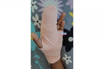 ކަނޑޫދޫ ސްކޫލް ޓީޗަރަކު ކުއްޖެއްގެ އިނގިލި ހުޅުން ނައްޓައިލި މައްސަލައެއް