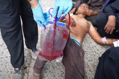 ޣައްޒާއިން ލޭ ލިބުން ވަރަށް ބޮޑަށް ދަތިވެއްޖެ