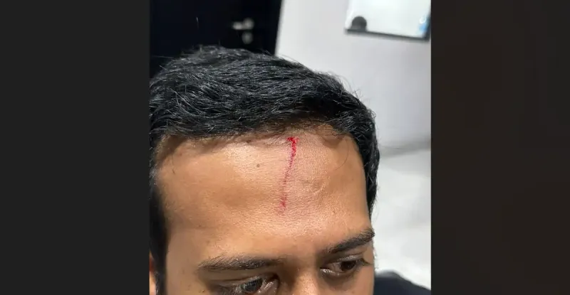 އެމްޑީޕީގެ މުޒާހަރާ އިން ހައްޔަރުކުރި މައިމޫން ޝަރުތުތަކާއެކު ބަންދުން ދޫކޮށްލައިފި